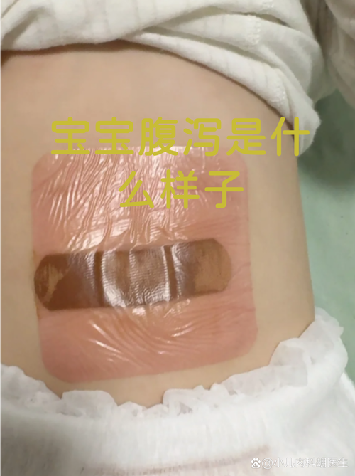 滲便是什麼