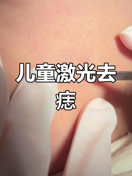 小孩幾歲可以點痣