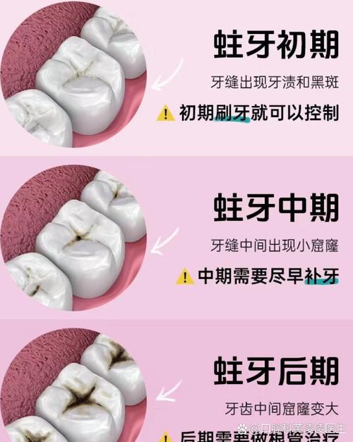 拔蛀牙會痛嗎