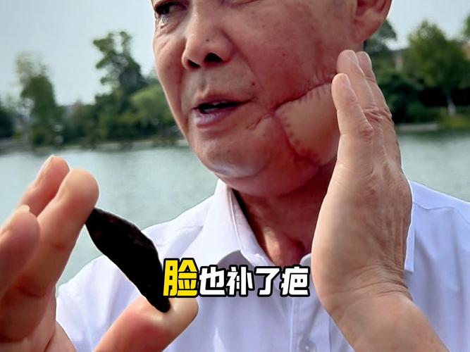 抽菸會得口腔癌嗎