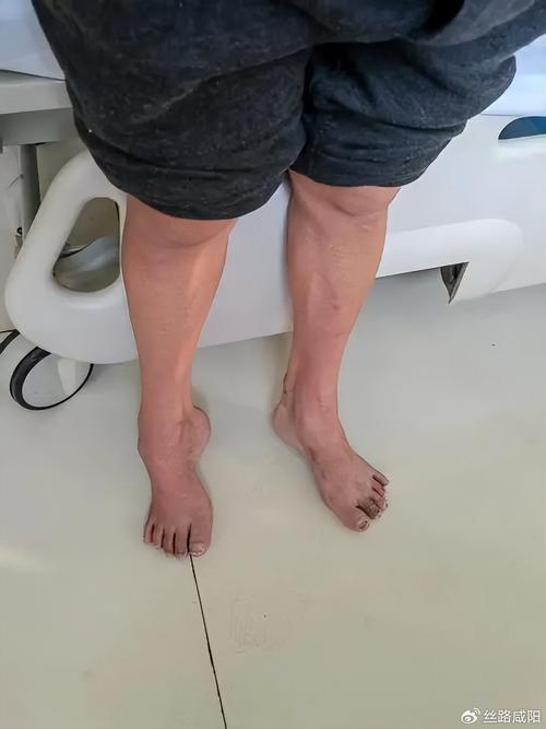 什麼是拐馬腳?洞悉棋局中的致命陷阱與解局之道 1 什麼是拐馬腳