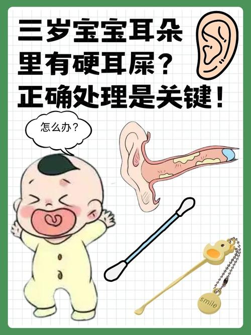 耳屎會自己分解嗎