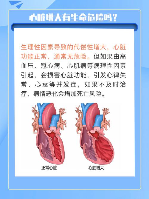 心臟為何會擴大?揭開心臟擴大成因與治療關鍵 3 心臟為何會擴大