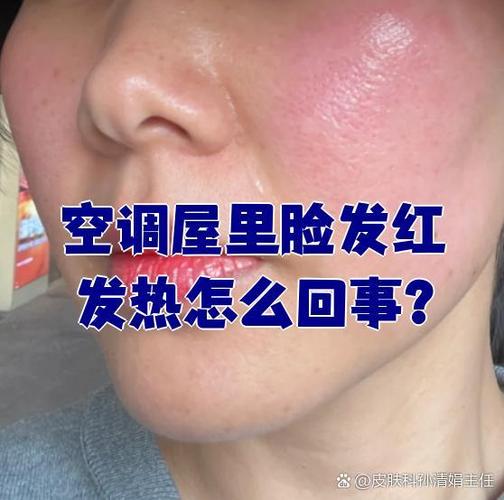 發燒為什麼會臉紅