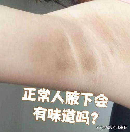 腋下有一點味道是正常的嗎