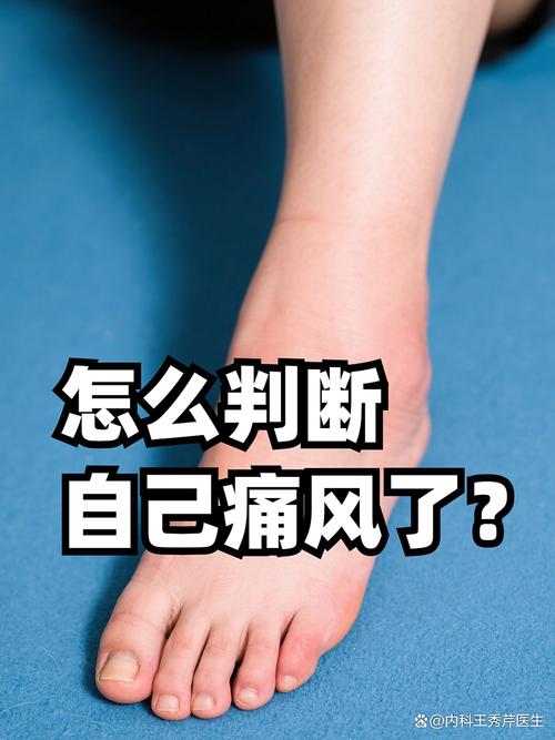 如何判斷是不是痛風