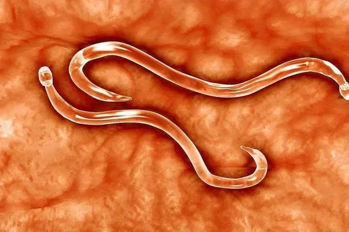 生魚片有寄生蟲嗎