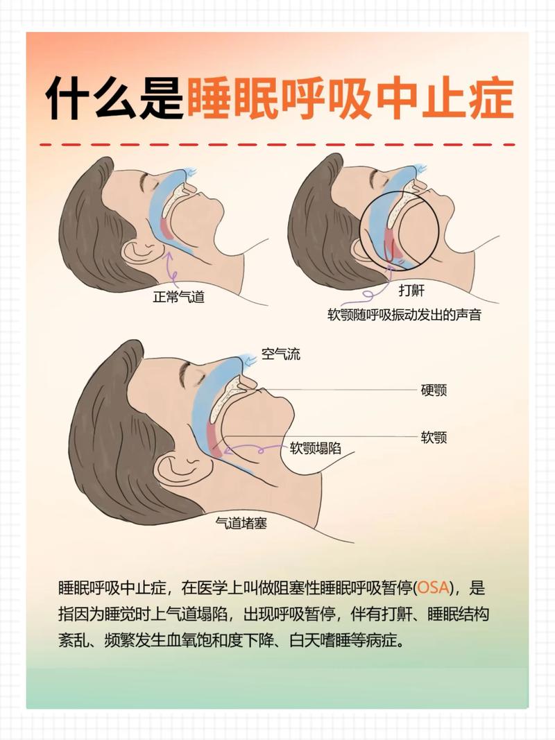 睡覺打呼可以治療嗎