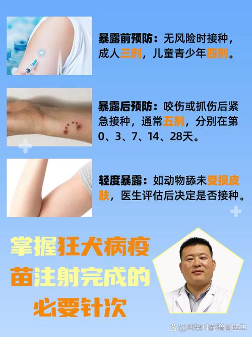 瘋狗症針幾錢