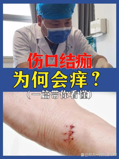 結痂癢
