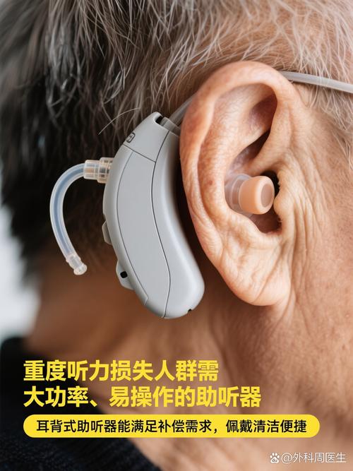 輕度聽損要戴助聽器嗎