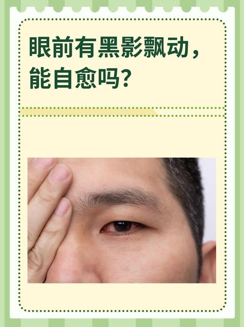 眼睛突然黑幾秒?揭開暫時性視力喪失的背後原因與應對之道 1 眼睛突然黑幾秒