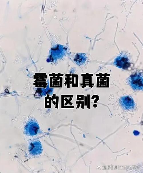 黴菌是哪一界?揭開真菌世界的神秘面紗,讓你一次搞懂! 3 黴菌是哪一界