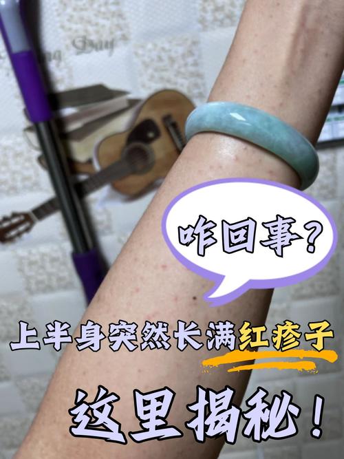 為什麼突然起紅疹