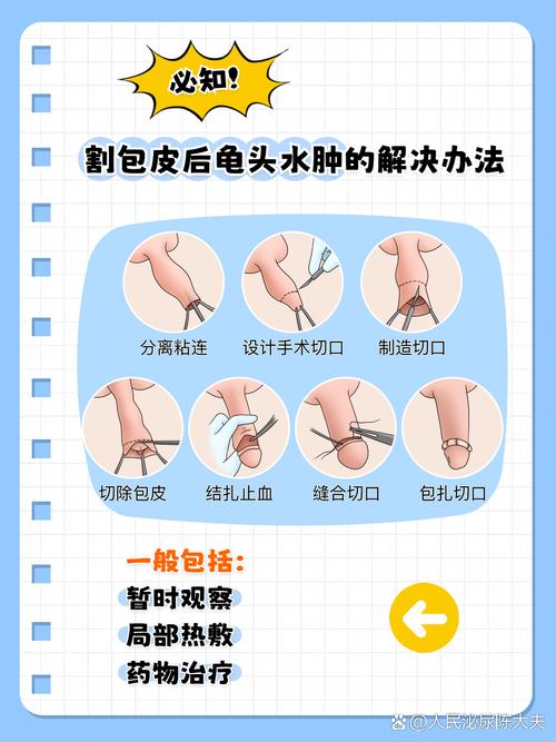 繫帶可以割掉嗎