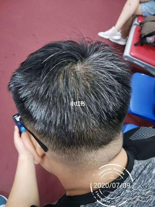 幾歲算少年白?揭開年輕人長白髮的年齡迷思與潛藏原因 1 幾歲算少年白