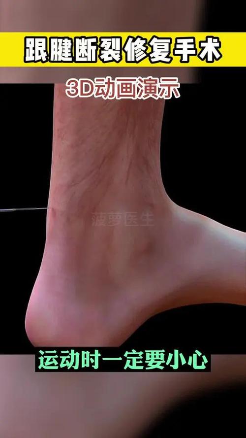 腳筋斷了還能走路嗎