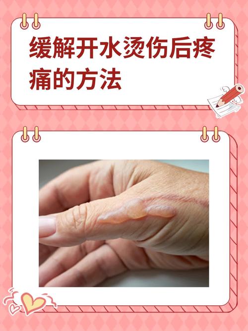 皮膚有灼熱感怎麼辦