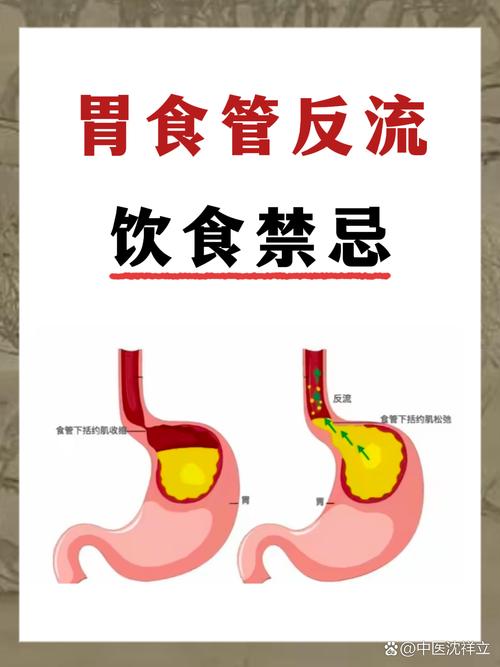 中藥可以治胃食道逆流嗎
