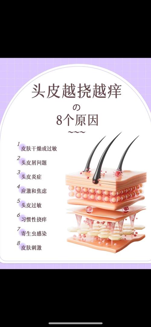 沒洗頭為什麼會癢