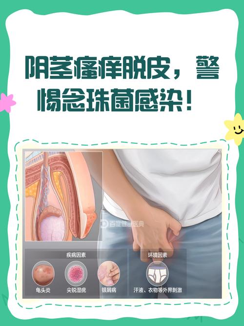 黴菌感染會癢嗎