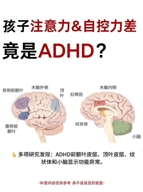 ADHD是精神疾病嗎