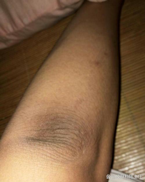 為什麼很容易黑